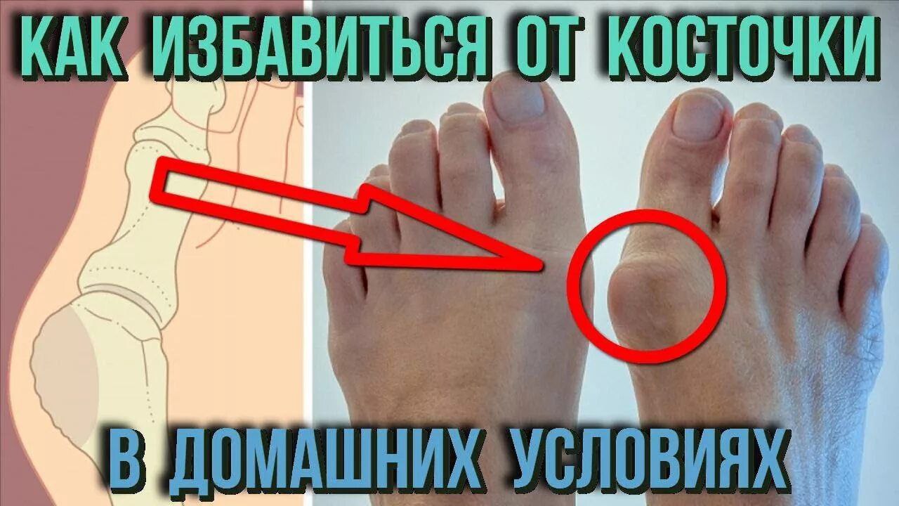 Мама знает как избавить от боли воспалившуюся ногу сына